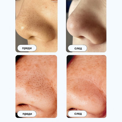 GLOWL Ленти за дълбоко почистване на порите