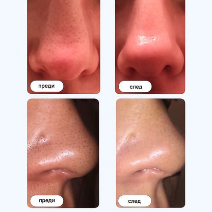 GLOWL Ленти за дълбоко почистване на порите